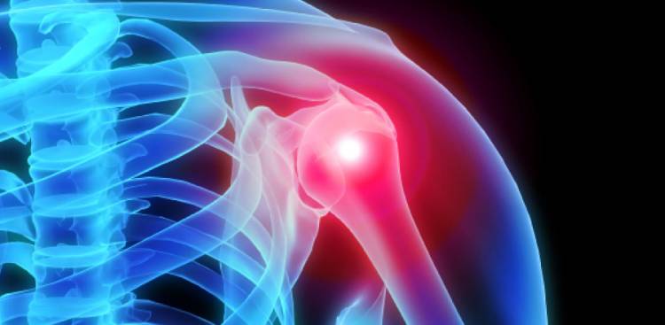 Most Common Joint Problems